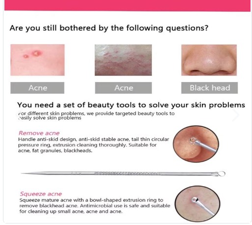 Extractor De Espinillas Y Puntos Negros